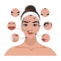 鼻整形の術後経過ブログまとめ：リアルな体験談と口コミ