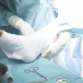 術後の腫れ・痛み・ダウンタイムについて：患者体験とアフターケアガイド