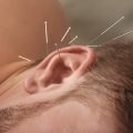医師が解説！自宅ケアと美容皮膚科治療の毛穴ケア効果の違いと賢い併用法