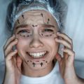 ダウンタイム・副作用を最小限に抑える糸リフト術後ケア方法